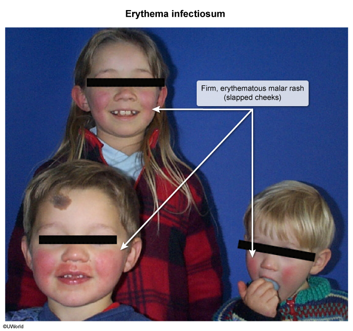 Pasted image 20250320105952.png