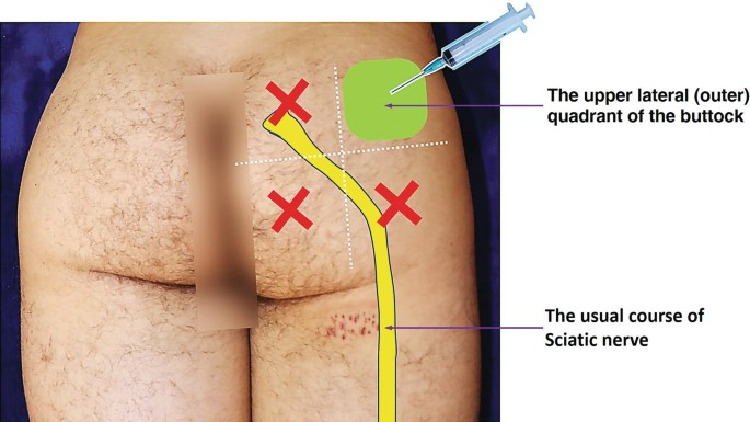 Pasted image 20250401162429.png