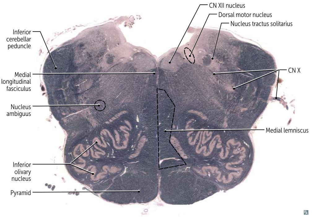 Pasted image 20250607160749.png