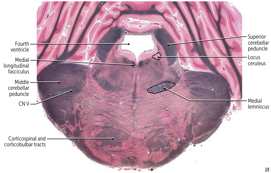 Pasted image 20250607160806.png
