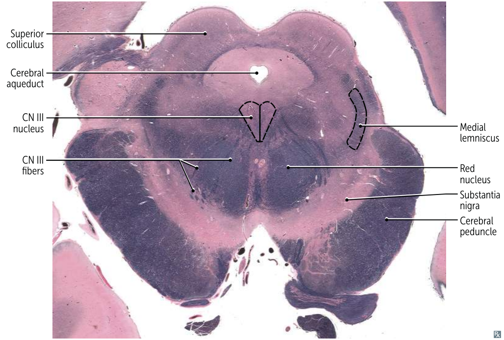 Pasted image 20250607160824.png